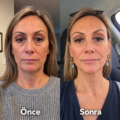 Kolajen Yüz Şekillendirici Maske